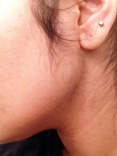 Before